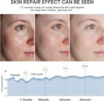 7-Color LED Red Light Facial Mask for Anti-Aging, Acne Treatment & Skin Whitening – Advanced At-Home Skin Rejuvenation & Beauty Device - Image 4